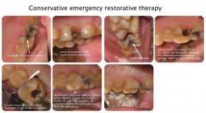 Conservative emergency restorative therapy 2